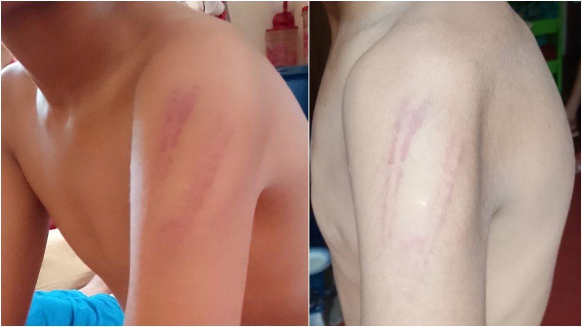 Student injured after alleged caning by religious teacher over inability to sing a song